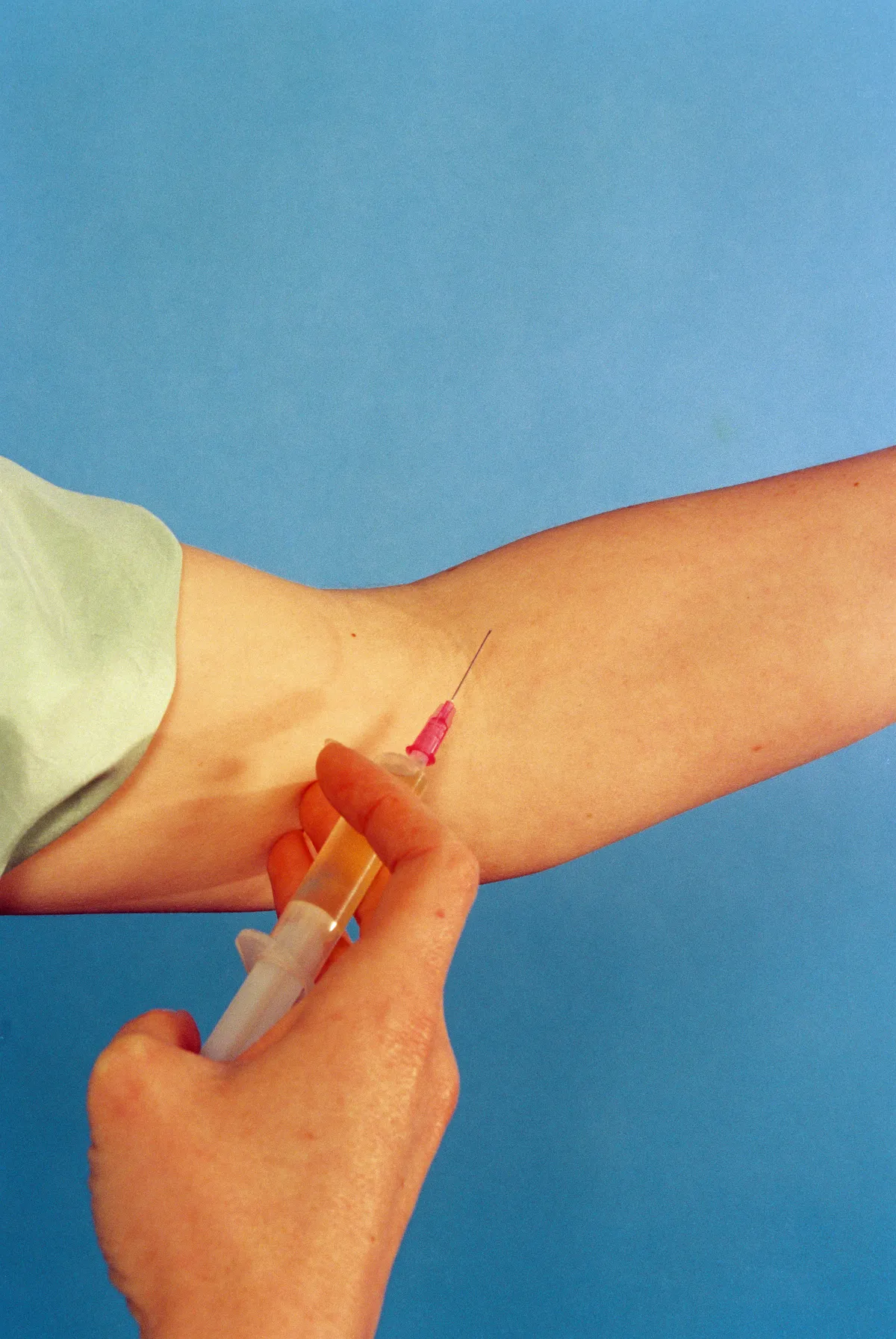 Young Women Increasingly Consider Botox Amid Health Concerns