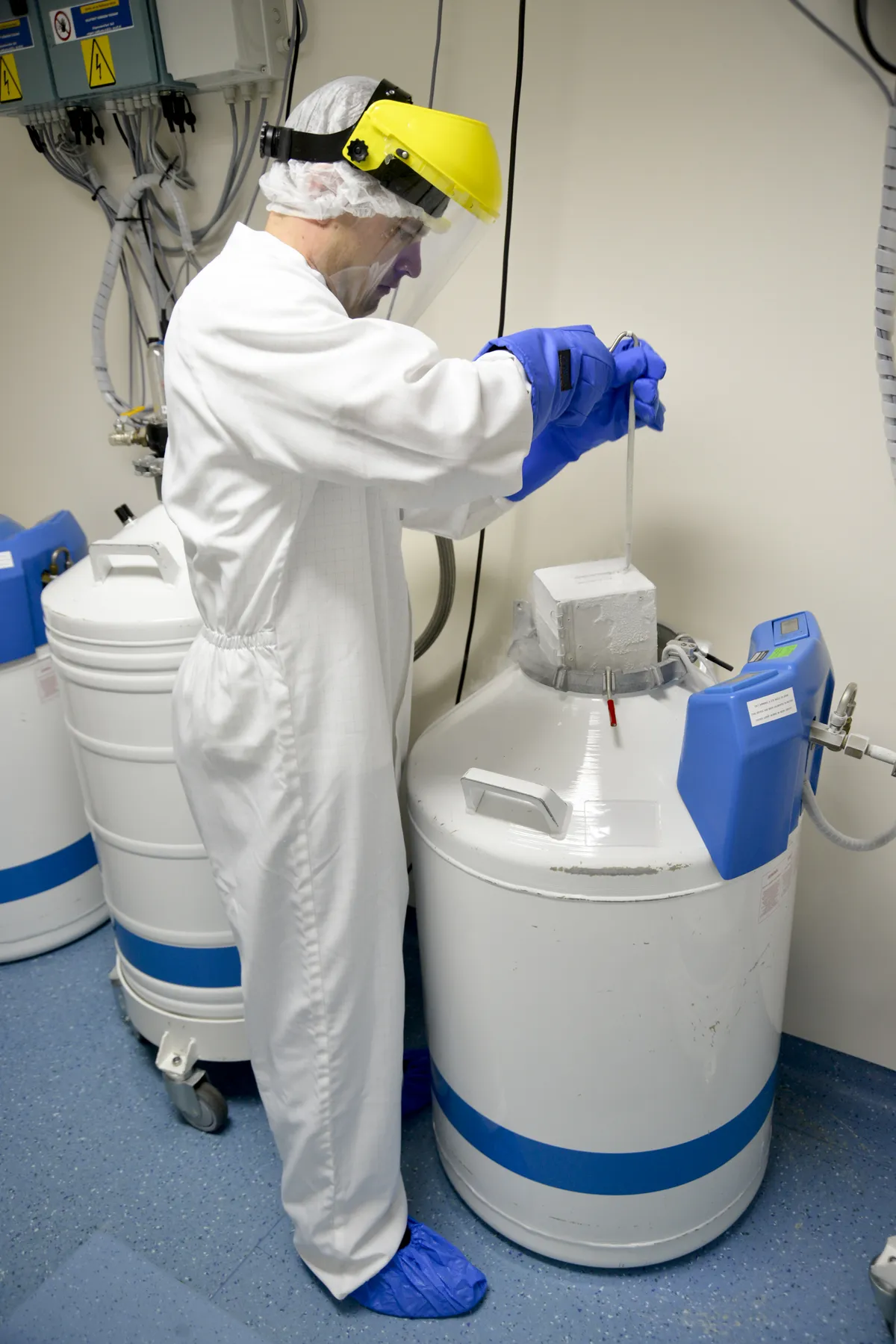 NHS pilot aims to boost transplants amid systemic failures and record waits