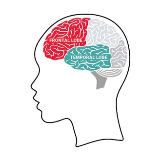 frontotemporal dementia (FTD)